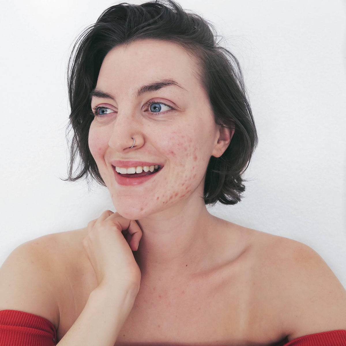 Acne is Normal: Skin with Lea Pt. 2