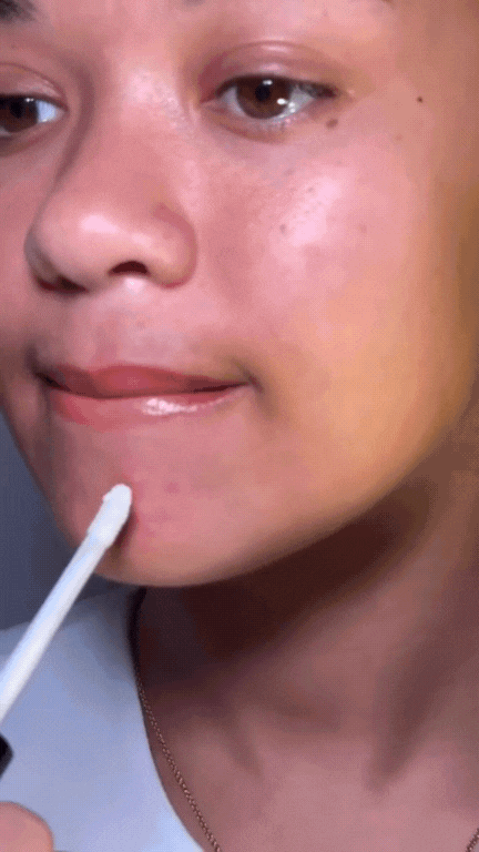 Break-Out Acne Spot Treatment