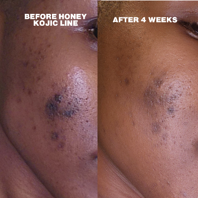 Honey Kojic Illuminating Moisturizer